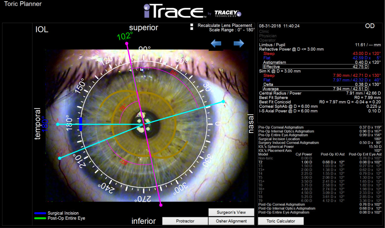 itrace example