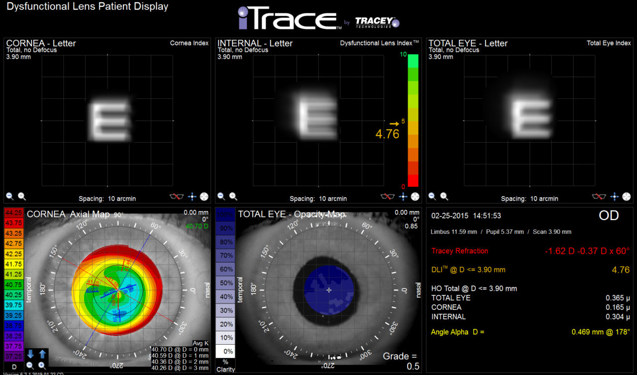 itrace ophthalmology