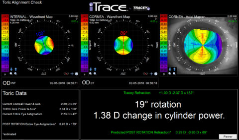 Why ITrace Autorefractor & Keratometer? | Tracey Technologies