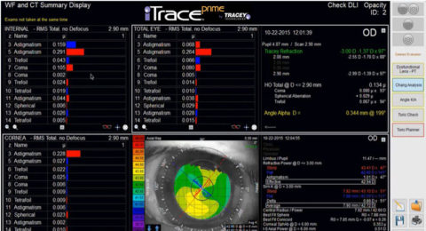 Why ITrace Autorefractor & Keratometer? | Tracey Technologies